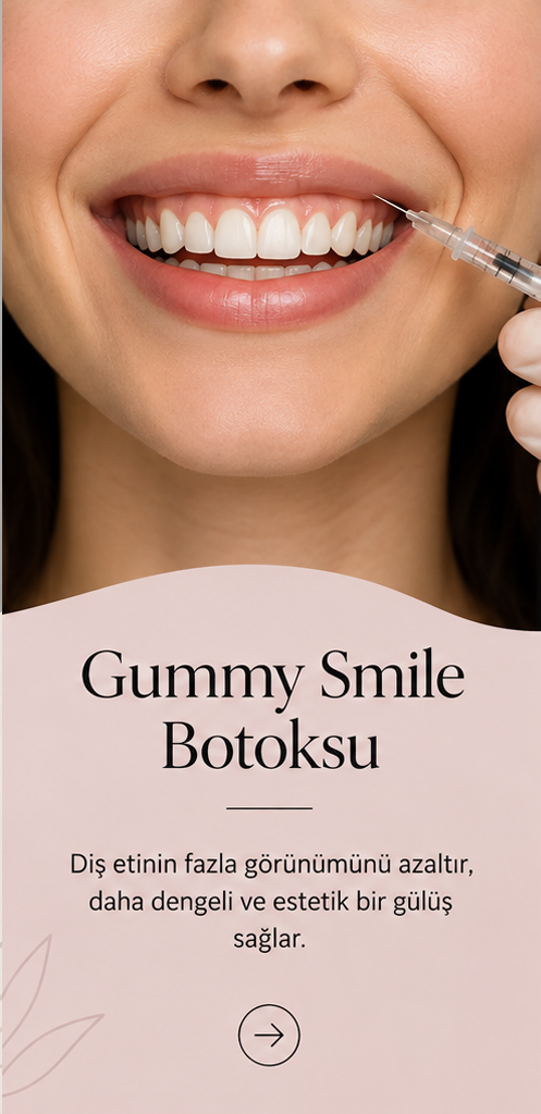 Gummy Smile botoksu uygulaması